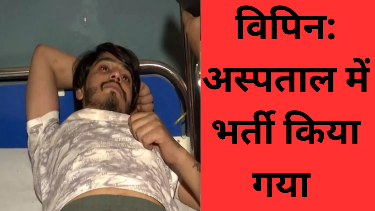 ग्रेटर नोएडा में पत्नी को जलाकर मारने के आरोपी विपिन का एनकाउंटर, पैर में लगी गोली